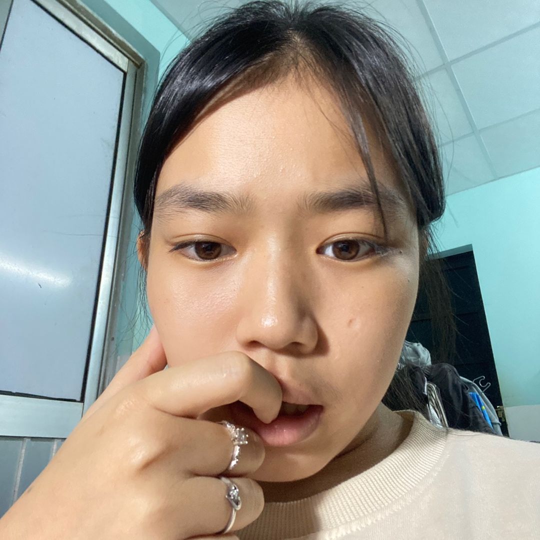 Quả Na Biết Nói