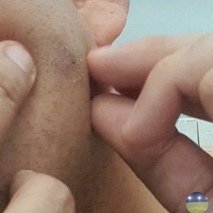 Terapia
