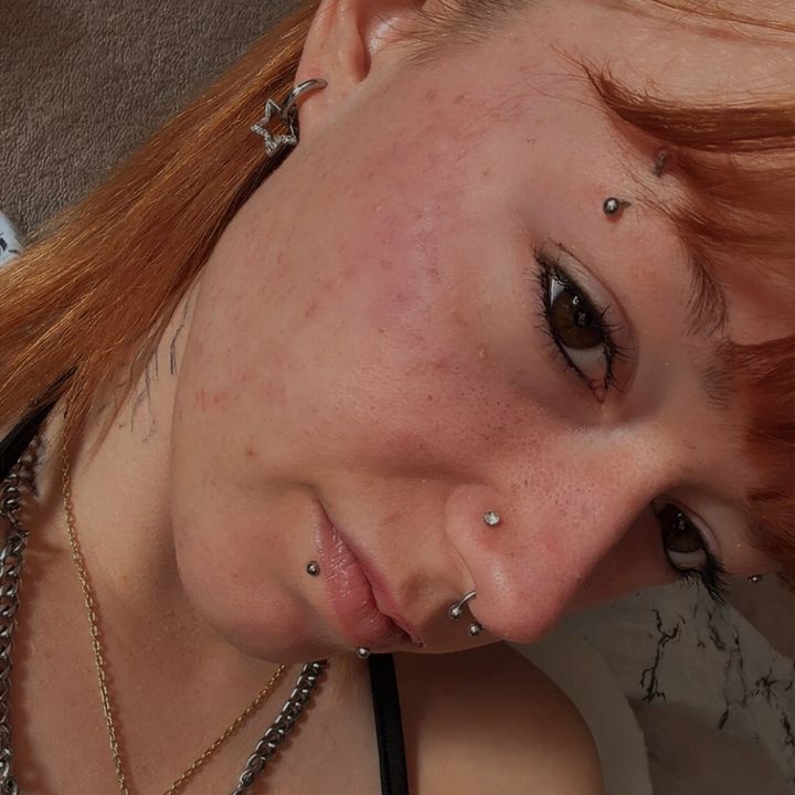 [Lex]
