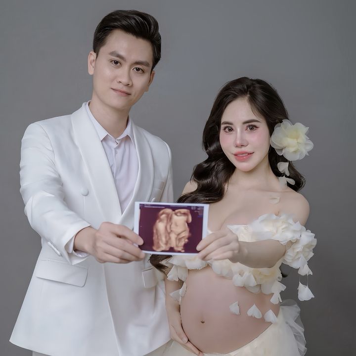 Tống Nơ Làm Mẹ 🤰🐍