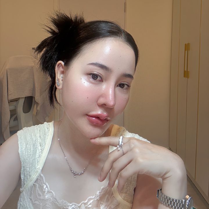 อุ๋งอิ๋ง สวยผ่อนได้