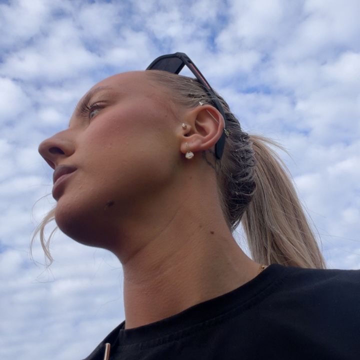 allex🕊️