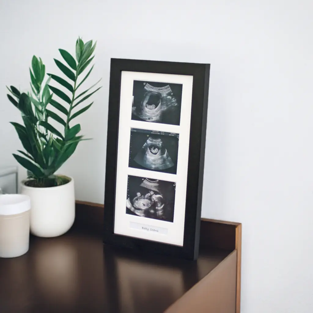 Baby Scan Frame - Nursery Décor - Wooden Photo Fra TikTok爆款商品分析 - GMV ...