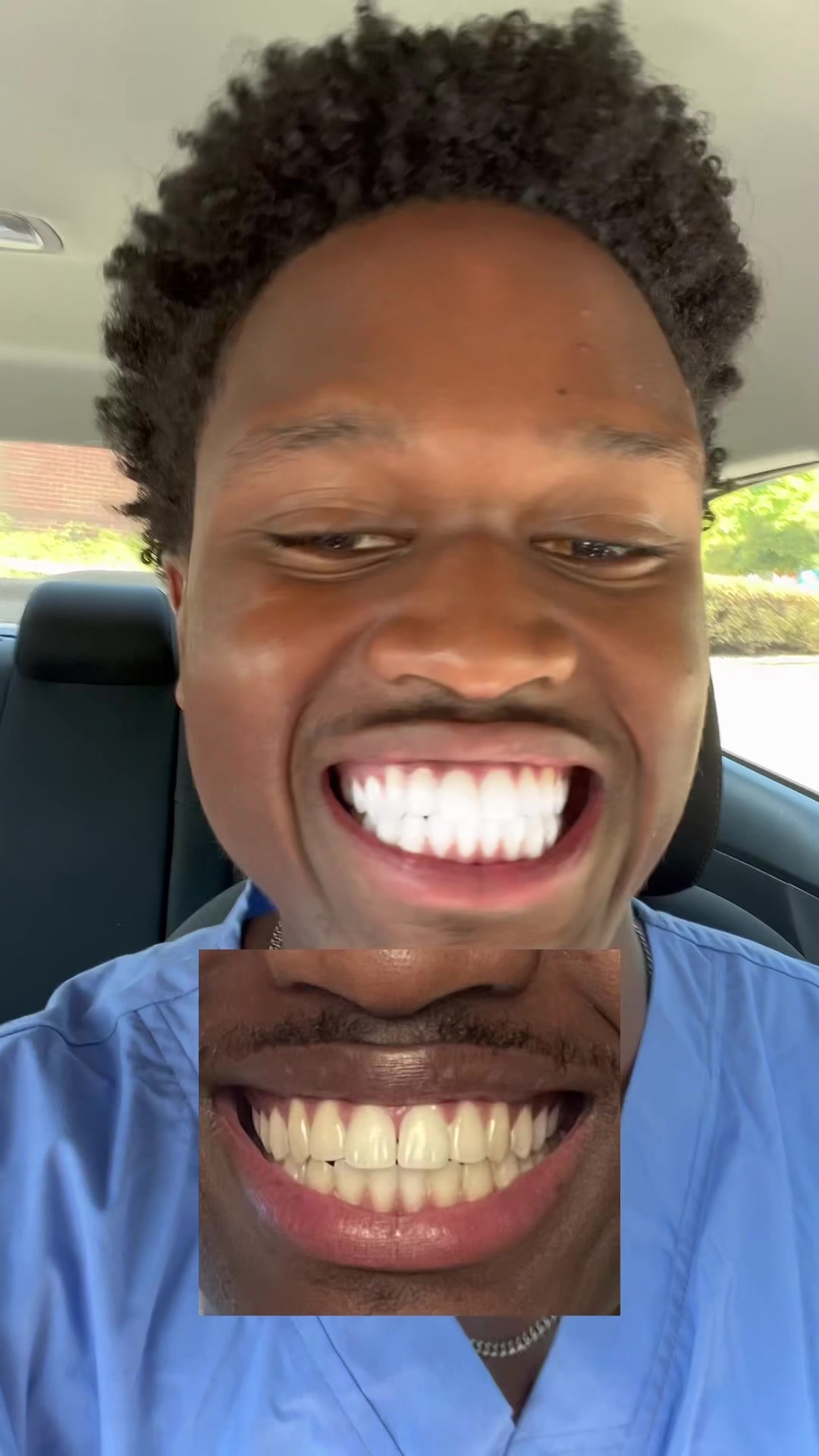 Teeth whitening on the go #dentalhygienist #teeth #teethcare #whitening 