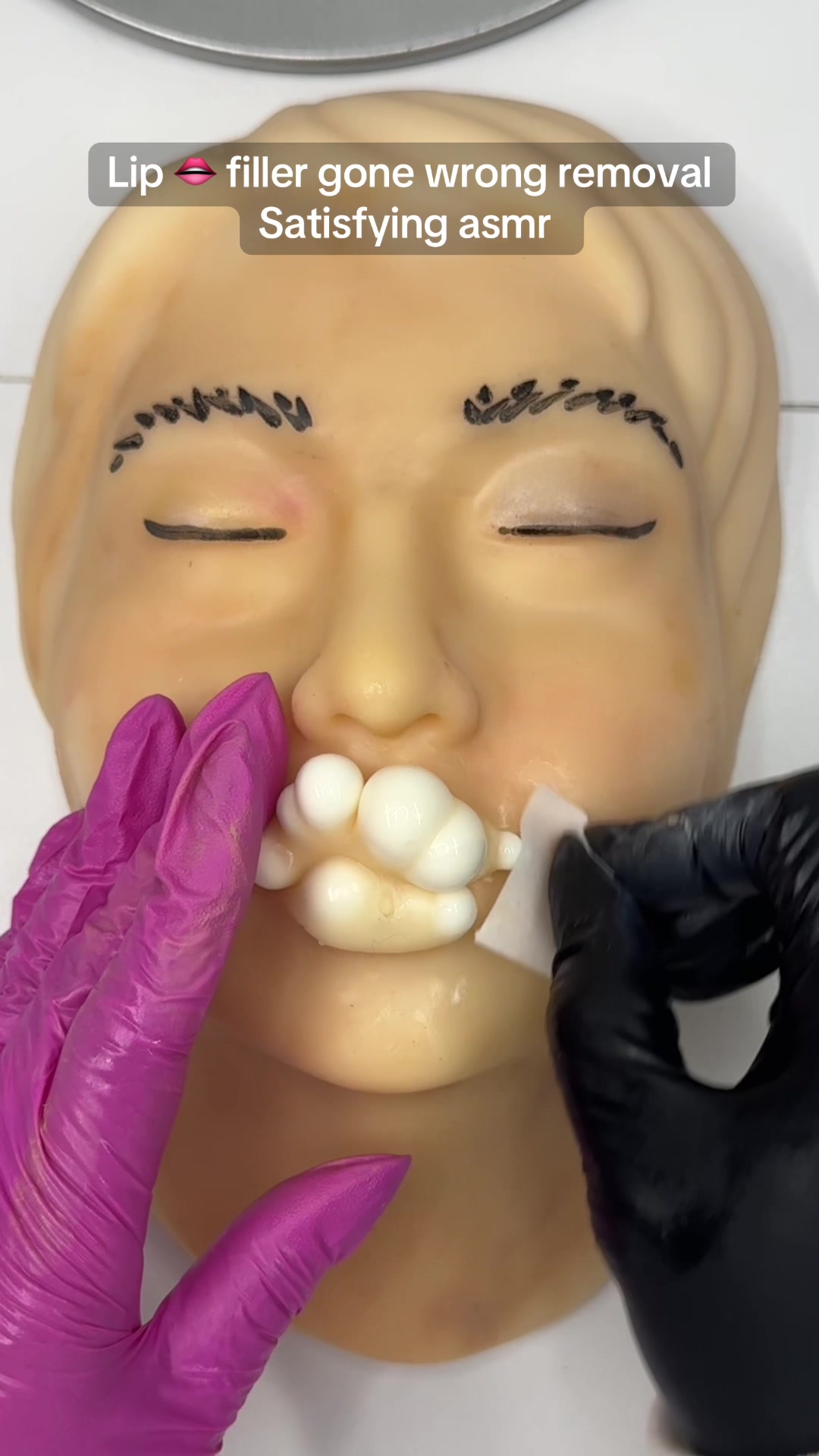Painfull lips pimple popping Relaxing  #asmrsounds #asmr #viral #fypシ #relax #skincare #mouthsounds #satisfying #tingles #asmrtriggers #mochipimplepopping #pimplepoppin #acnetreatment #asmrtiktoks  #lip #lipfiller #biglip #CapCut 