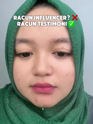 Racun Influencer?❌ Racun testimoni ✅ Emang andalan banget ini serum Acneno 😍 @Acneno Indonesia  #TestiMurniAcneno