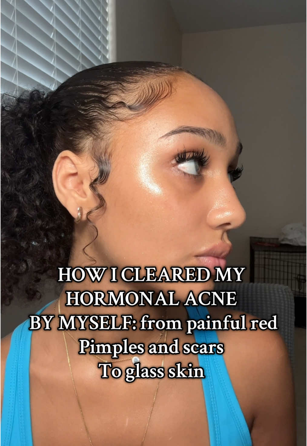 POV: You’re about to find out how I cleared my hormonal acne without spending $1000 on skincare and doctors. Real results, no gatekeeping. #hormonalacne #acneproneskin #clearskin #acneproblems #skincaretips #beforeandafter #fyp #selfcare #nailahjadee 