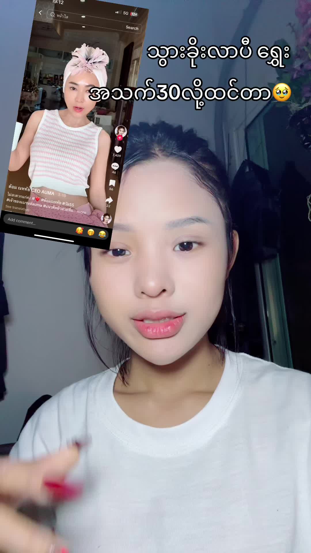 မနေနိုင်လို့ ခိုးလာပီ❤️#မျက်နာဖြူချင်သူများအတွက် #အရွယ်တင်နုပျိုစေဖို့အတွက် #ခြင်းဝါလေးထဲဝင်ဝယ်လို့ရတယ်ရှင့် 
