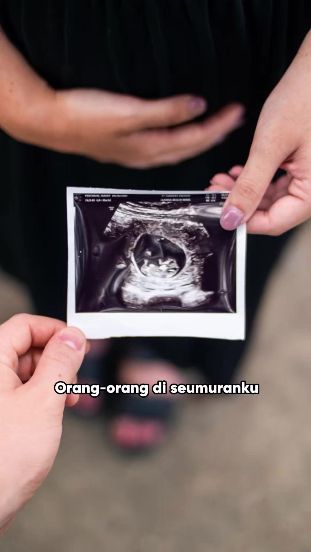Minum Teh Rimpang rutin 2x sehari, bantu kurangi gejala PCOS dan bantu seimbangkan hormon 🥰 #NaimaTehRimpang #naima #TehRimpangAlami #drzaidulakbar #antiPCOS #tehrimpang #tehrimpangnaima #tehrimpangbpom #tehrimpangori 