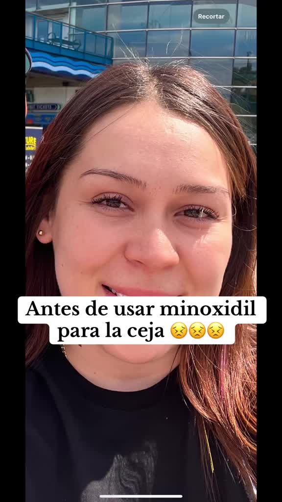 Usen minoxidil si quieren su ceja gruesa 😍😍 #minoxidil #cejasperfectas #ceja #skincare #tips #amigas #tiktokshop #fyp #fypシ #parati 