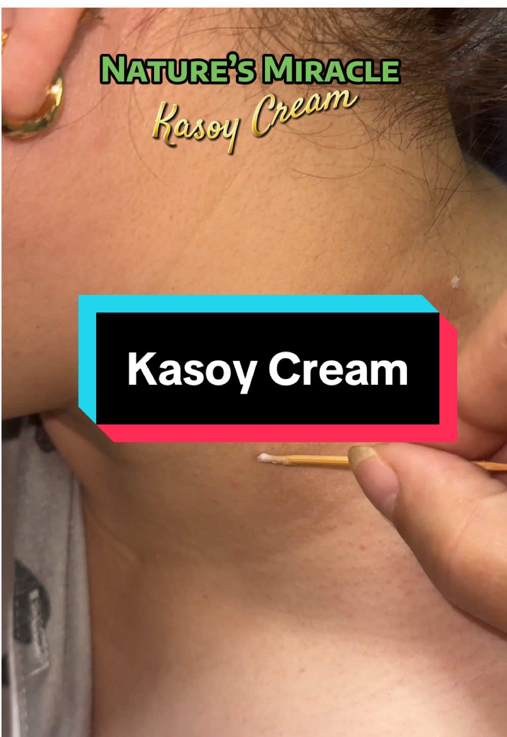 Kung kagaya din kita na may mga ganitong problema, icheck out mo to.  #naturesmiracle #kasoycream #skinproblem #herbal #organic 