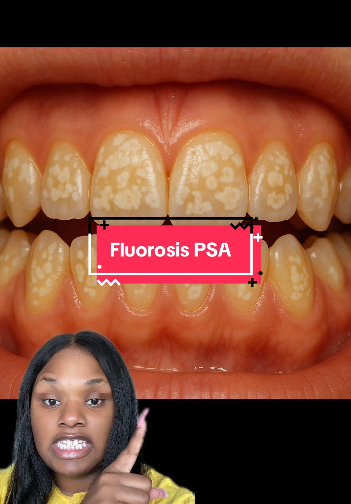 Say bye to spicy toothpaste burn! Boka Whitening Toothpaste is fluoride ...