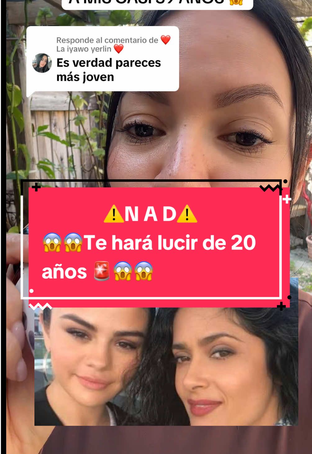 Respuesta a @❤️ La iyawo yerlin ❤️  El suplemento de la juventud amiga!!!! Más hermosa joven y llena de energía 🚨🚨🚨💪 #nad #supplements #suplementos #juventud #famosas #energia #fyp #viralvideo #viralproducts #supplements #viraltiktok #paratii #antiedad #resveratrol #suplementosnaturales #envejecimiento 