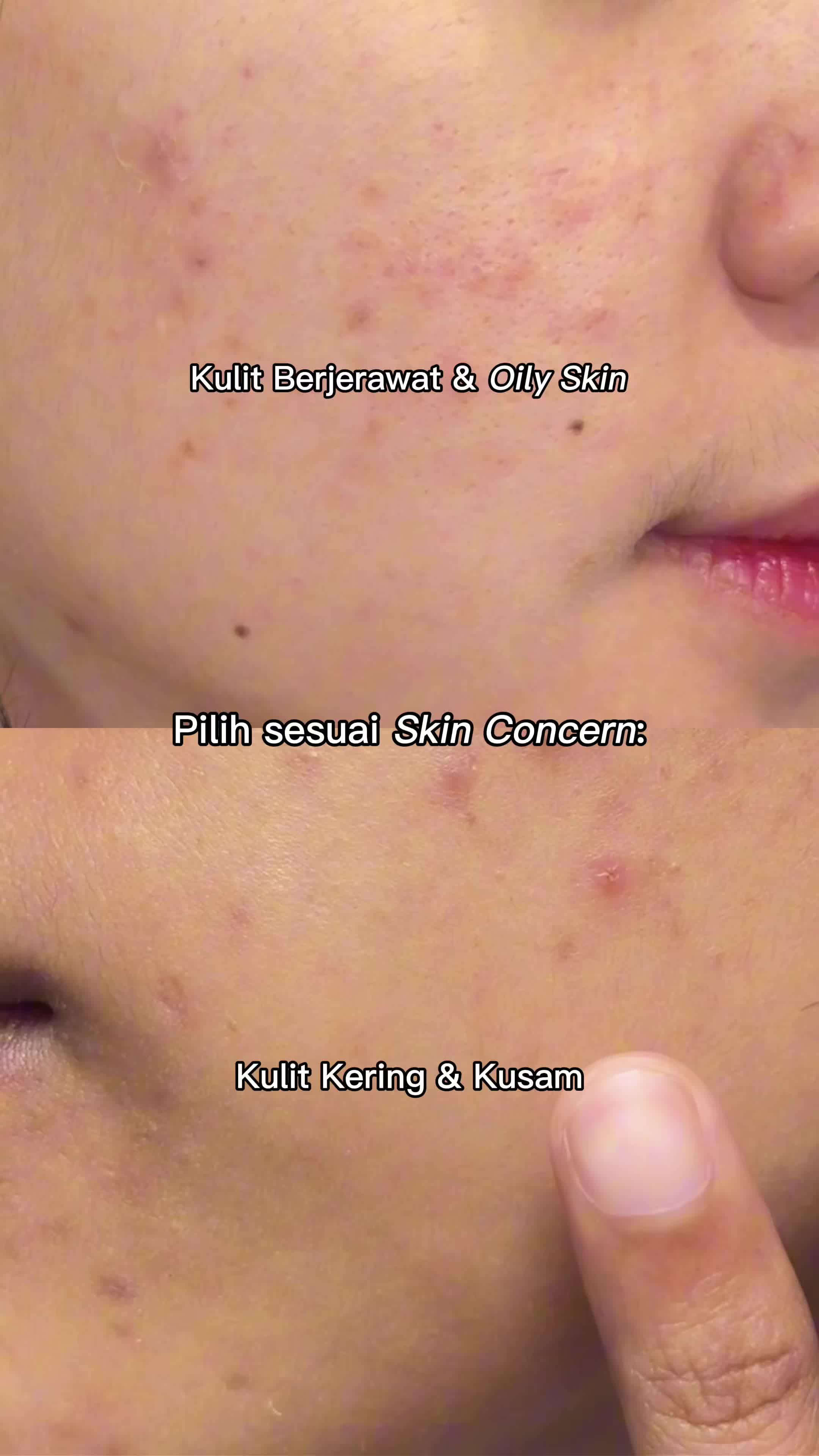 kenalin skin concern kalian apa, dan jangan sampai salah polih sunscreen ya🤩 #Emina  #EminaSunBattle  #RekomendasiSunscreen  #SunscreenEmina #SunBattleSPF35 #SunscreenJerawat #Sunscreenpelajar #sunscreenremaja  #sunbattle35brightglow 