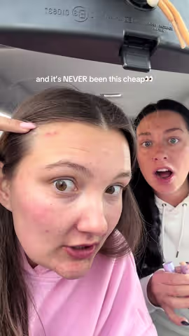 The way this makes everything disappear 🤯 shades are selling out so quick!! @tarte cosmetics #shapetape #breakouts #makeup #skinhelp #blurringstick 