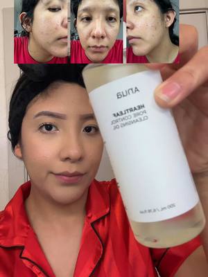 Estoy impresionada como se está recuperando mi piel después de 2 semanas de estar haciendo la rutina de doble limpieza 🫶🏻#skincare #routine #doblelimpiezafacial #korean #facial #Anu #set #pielsana #paratii #tipsforgirls #pieldeporcelana