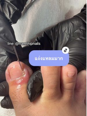 💓 #namthipnails #ตัดเล็บขบ #ตัดหนัง #ทำเล็บ #ร้านตัดเล็บขบ #ร้านตัดเล็บขบราม2 #ร้านทำเล็บ #เล็บขบ  #เล็บเชื้อรา Fb : namthipnails  Line : @namthipnails  นัมเบอร์วัน8 ตลาดม.ราม2  กทม  Map: namthipnails  https://goo.gl/maps/JmwpCKLfKwmhKGK96  ร้านเปิดทุกวัน เวลา12.00น-22.00น.