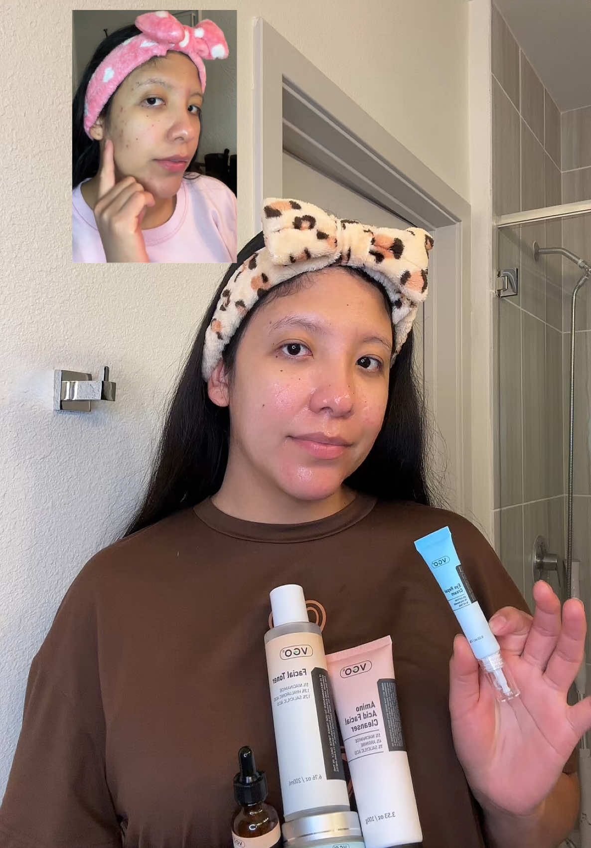 Me encanta esta rutina y los cambios que he visto en mi piel ✨#vgo #vgobeauty #rutina #skinkare #pielsana #manchas #manchasdeacné #acne #parati #beutyhacks #VGO 