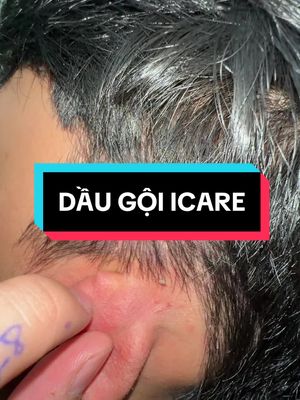 Hay lắm mn 😭 a bị thì thử nha #fyp #hnghiaa 