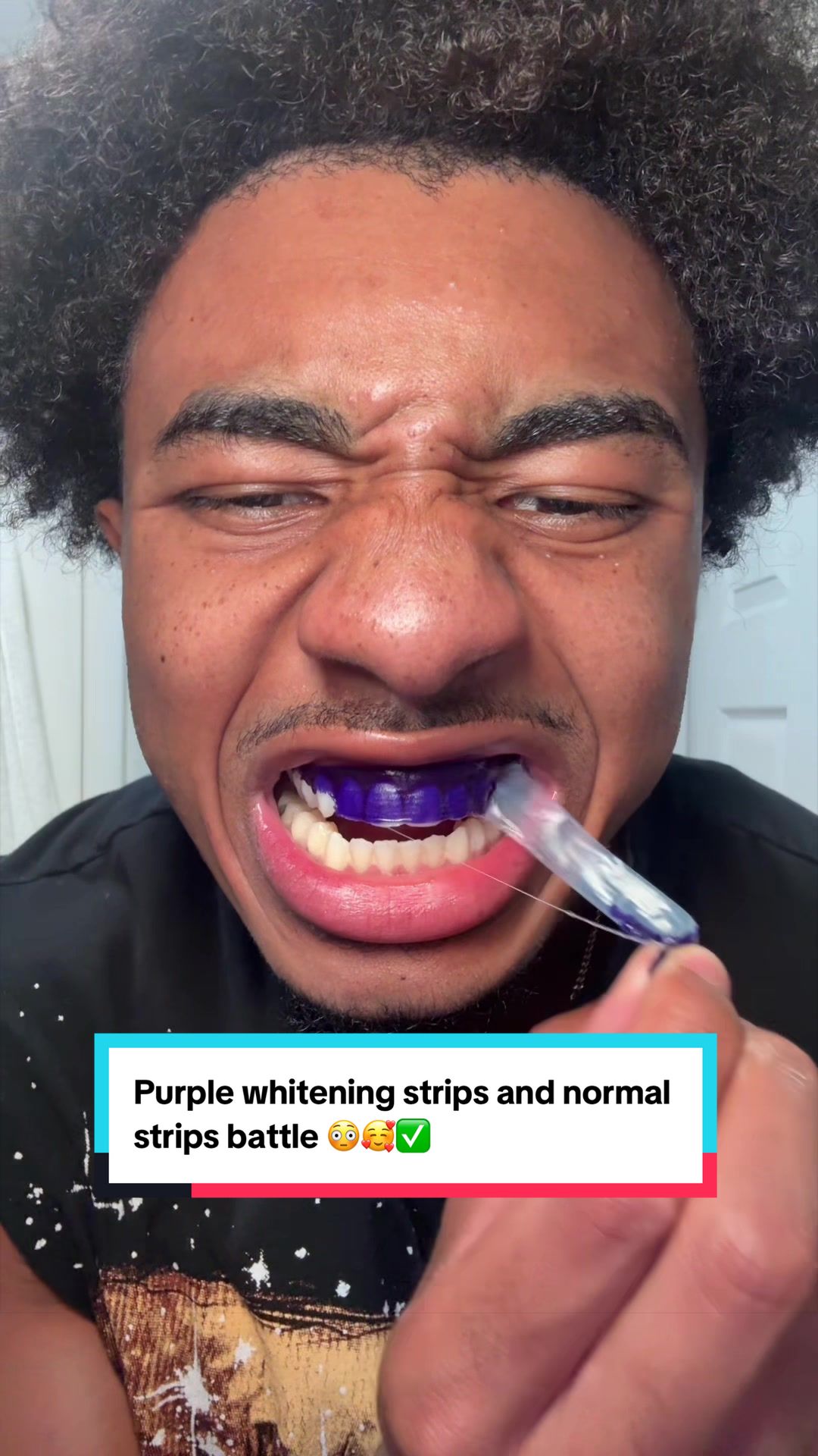 Wow….Just wow!#tiktokshopcreatorpicks #whiteningstrips #yellowteeth #teeth #drdent 