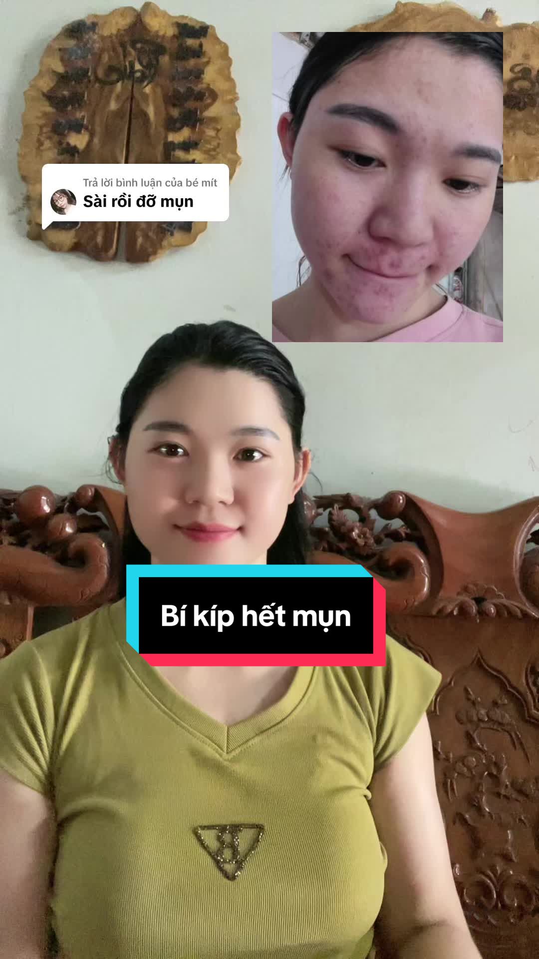 Trả lời @bé mít chân ái của tui nè mấy bà#bichvien #xuhuong #cogaihagiang #kemtrimun #beuacnes 