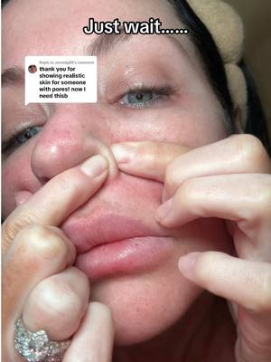 Replying to @Jennidg08  35 years of trying everything, and this is what finally changed my large pores. Insaneeeeeee….Korean beauty is living in 2050 I swear.  #Drmelaxin #skinexfoliating #skincare #peelshotglow #exfoliation #riceexfoliator #tiktokshoprestock 