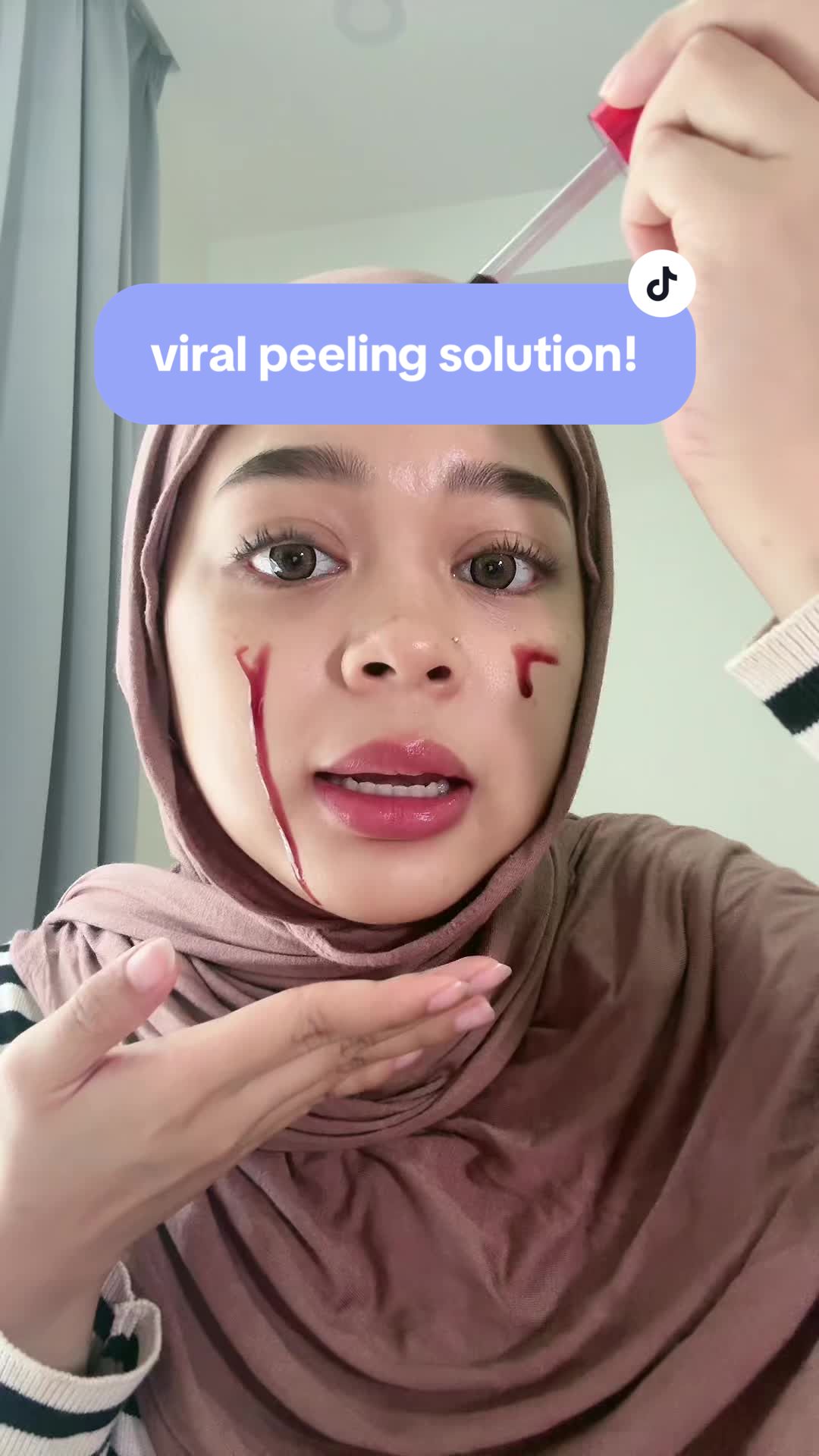 opkos la saya teracun jugak benda viral ni #peelingsolution #skintific 