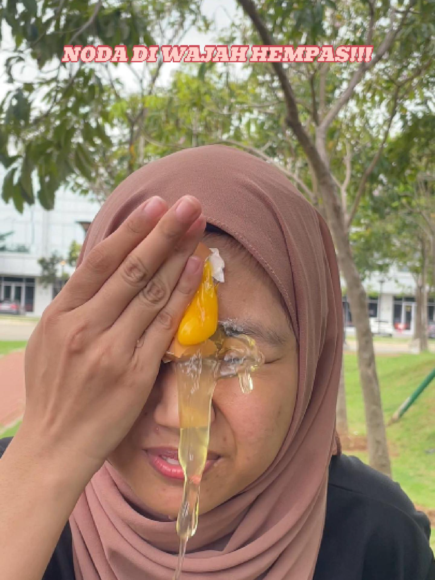 Kamu punya permasalahan wajah gelap, kuning dan berminyak? cobain deh pakai Cyeecare! #belilokal #skincareviraltiktok #wajahglowing #hydratedskin #wajahkusam #glowingskin #cod #niacinamide #glowup #facial #eksfoliasi #makeup #wajah #hydrated