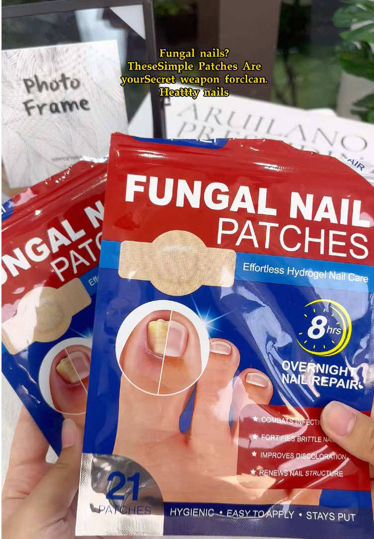 Fix Ugly Nails Overnight! - These Miracle Patches Saved My Nails##NailTok#FiYourNails #FungalNailSolutin #AmazonMustHaves#TikTokMadeMeBuyit #SkincareBÚtÃorNails#NailTransformation #BeforeAfter #SelfCareTools #HealthyNailsJourney#OverightFix #byeuglynails