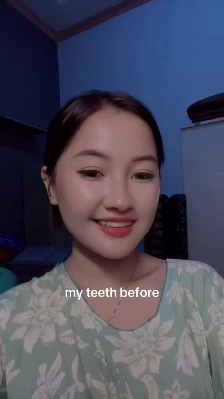 ayang pasti makin suka #gosmile 