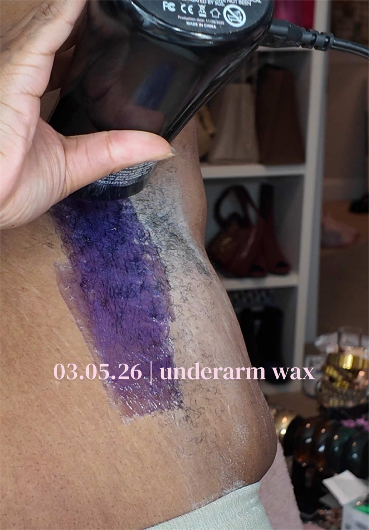 03.05.26 | 1.5 years since my last #underarmwax ft. @Tress Wellness (Digital Hard Wax Roller + Beginner Wax Kit) #tresswellness #hirsutism #hirsutismwax #pcoswax