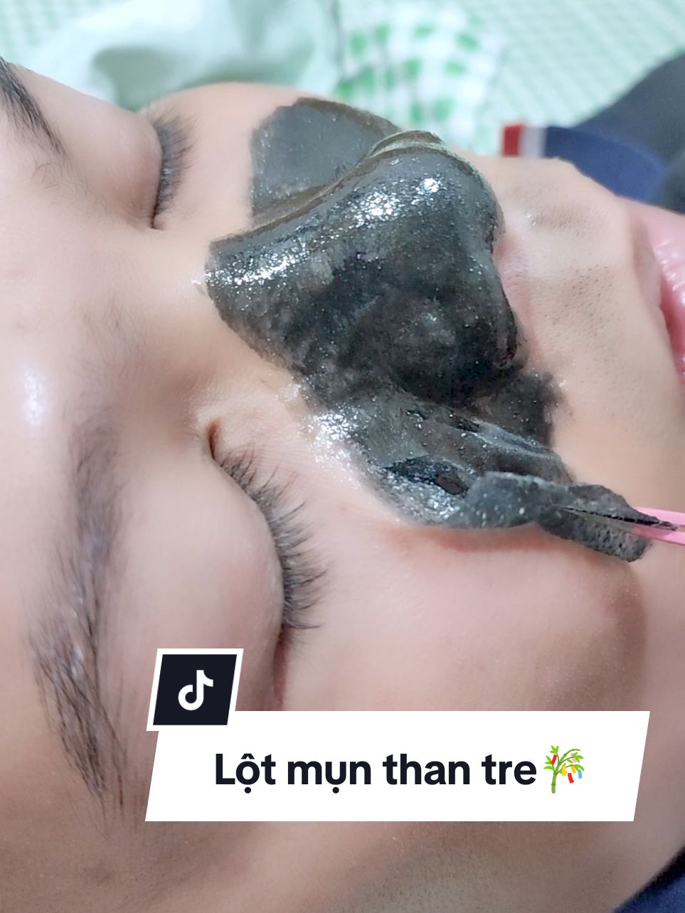 Lột mụn than tre... 🎋 #lotmundauden  #lotmunthantre  #lotmuncam  #lotmuntainha  #longvo 