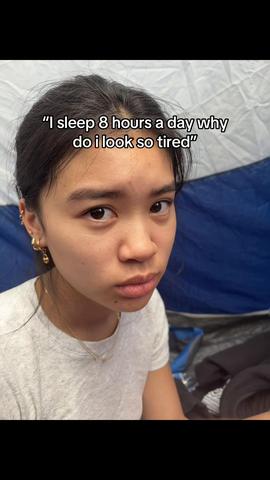 I’m so shocked with this ngl #eyebags #darkcircles 