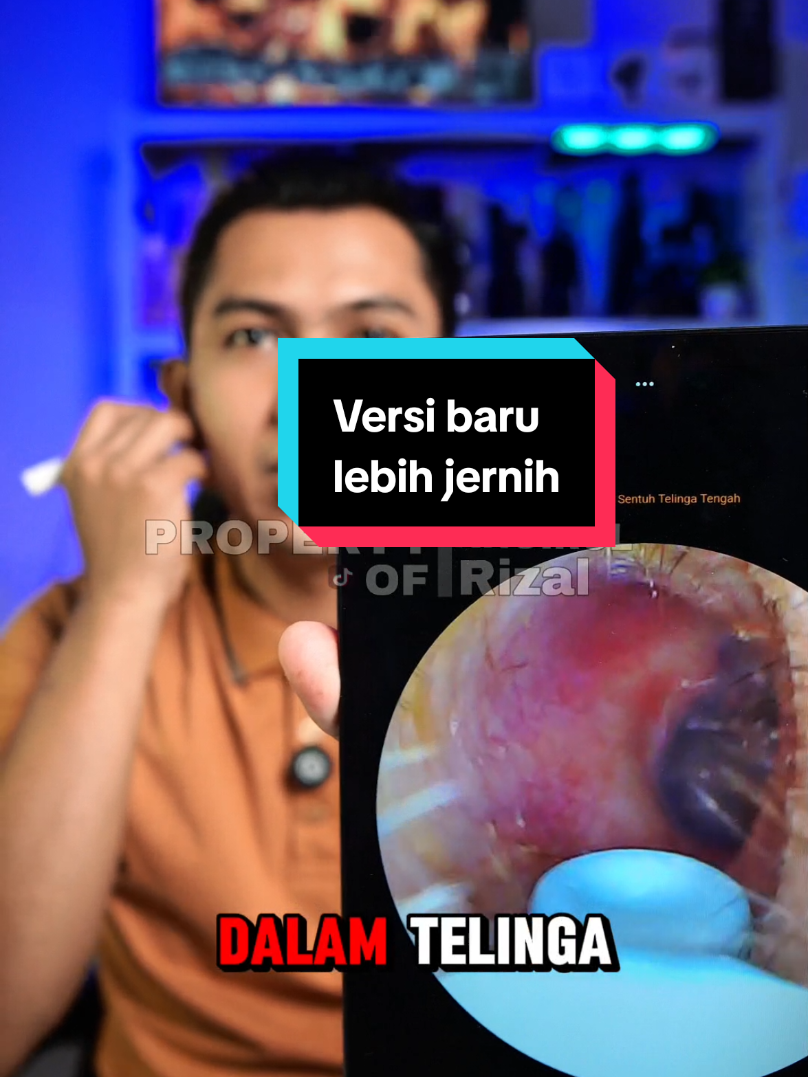 Korek kuping kamera ter baru dari brexia yg sudah ada penutupnya #KorekKupingKamera #KorekKupingKamera #KorekKupingPintar #KameraPembersihTelinga #EarCleanerCamera #KorekKupingDigital #KorekKupingInovatif #KameraKorekKuping #KorekKupingTerbaik #AlatPembersihTelinga #EarCamera #KorekKupingTeknologi #PembersihTelingaCanggih #KorekKupingSmart #KorekKupingHD #AlatKesehatanTelinga