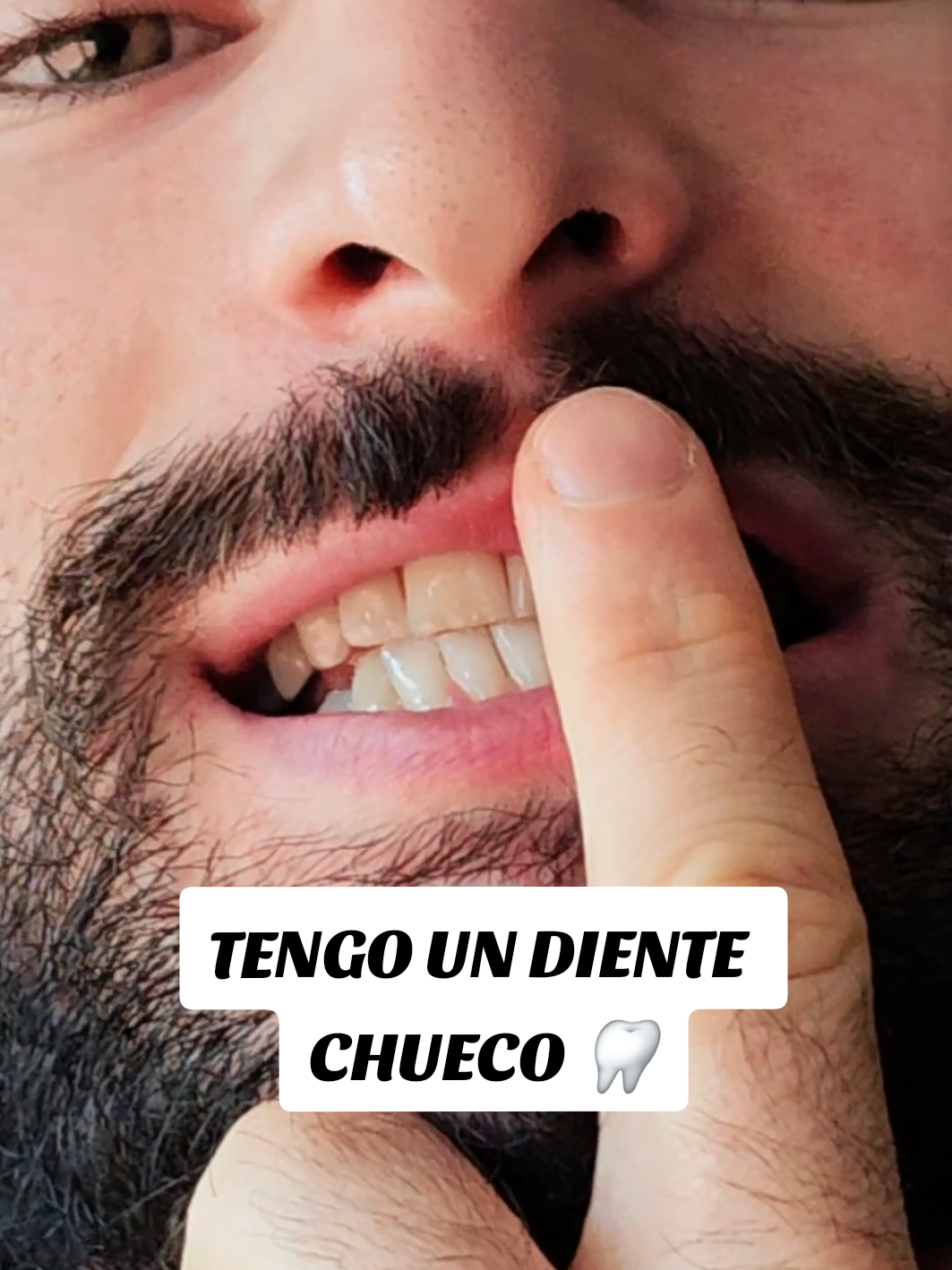 Así cuido mi diente chueco 🐊  Si estaban pensando en comprar este irrigador bucal y no estaban convencidos, puedo confirmarles que funciona tal y como se promociona. Yo no recomiendo cualquier cosa.  @COSLUS-Cuidado Bucal #coslus   