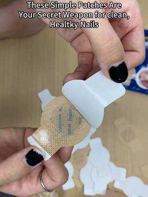 "Funky nails? Not anymore. These patches are SAVING toes #NailTok #FootCare #FungalNails #NailFix #BeforeAndAfter #GlowUp #SelfCareHacks #TikTokMadeMeBuylt #BeautyTools #NailTransformation #HealthTok #ToenailCare #DailyRoutiine #nomorefungus