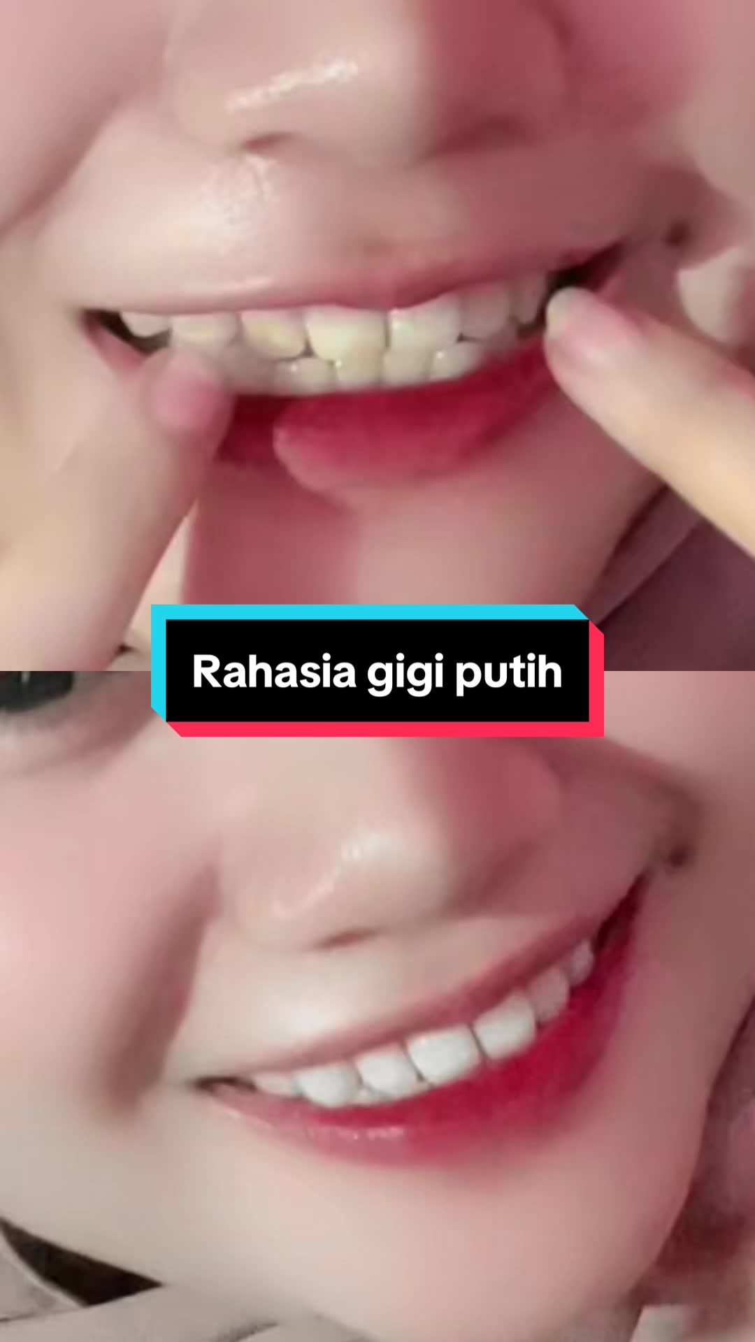 Wajib banget sih cobain pasta gigi ini #bodyaccel #whiteningtoothpaste 