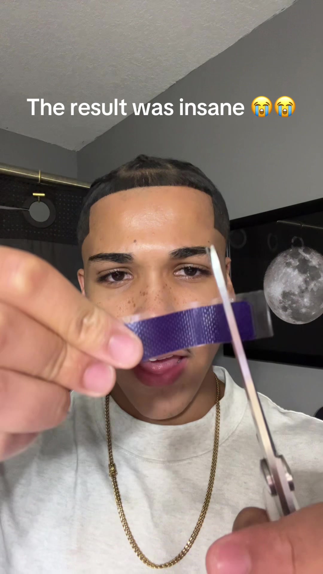 Crazy how they work #whiteningstripes #drdent #tiktokmademebuyit #yellowteeth