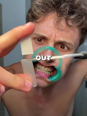 These are worth the hype #teeth #oralhealth #teethwhitening #teethcare 