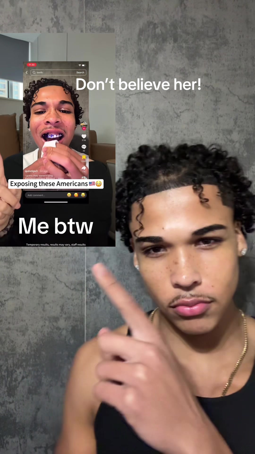 My favorite strips on the market #whiteningstripes #drdent #tiktokmademebuyit #yellowteeth