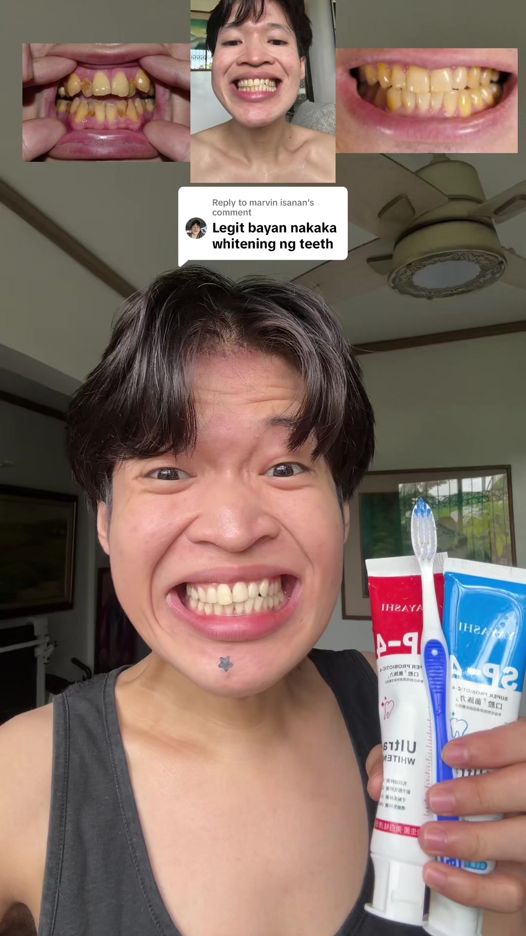 Replying to @marvin isanan Gumamit kana den ng Whitening toothpaste  #fyp #whiteningtoothpaste #yellowteeth #whiteningteeth #teeth #toothpaste 