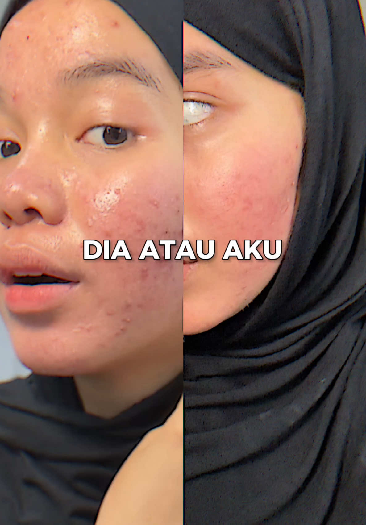 No efek pemulus 😒