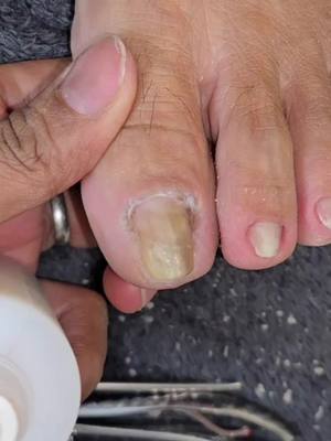 unlimited dryskin #manikuristangligaw 