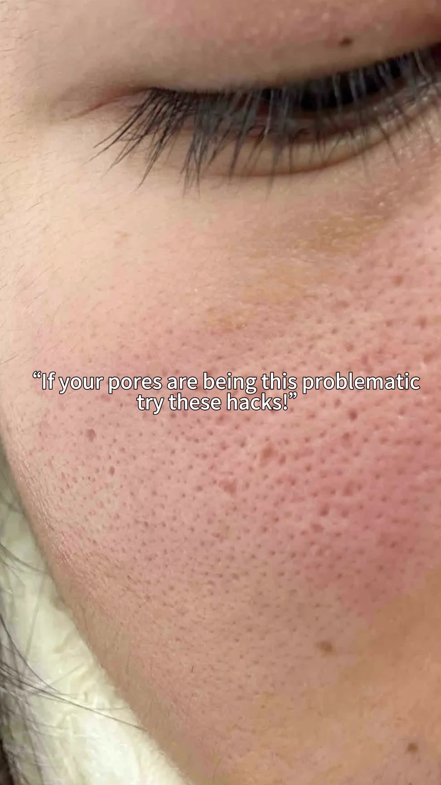 Try this!#SkincareHacks #glycolicacid #skincare #beauty 