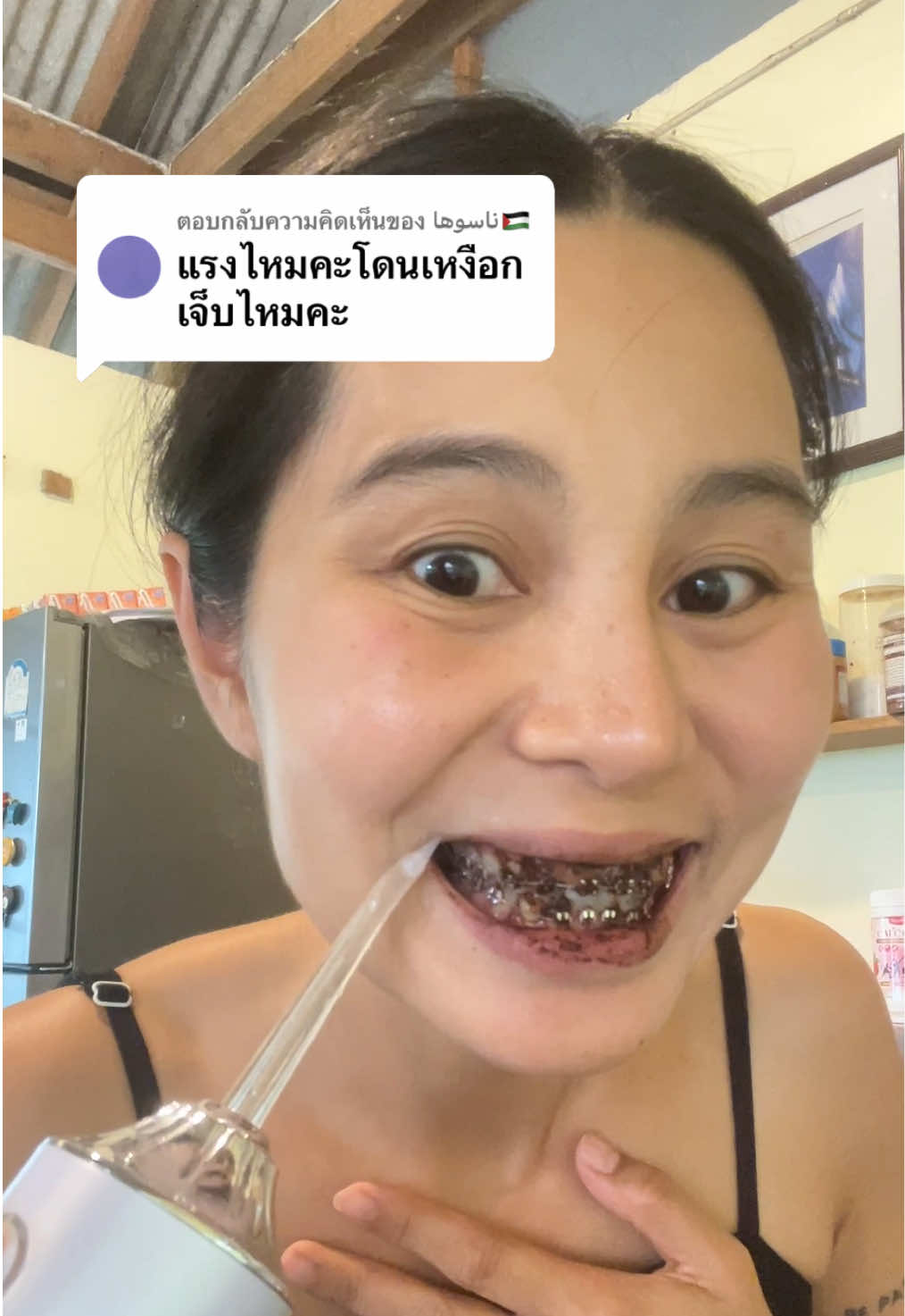 ตอบกลับ @ناسوها🇵🇸 ไม่เจ็บสักนิดเลยค่ะ #ไหมขัดฟันพลังน้ํา #ไหมขัดฟัน #จัดฟัน #ดัดฟัน #ปากเหม็น 