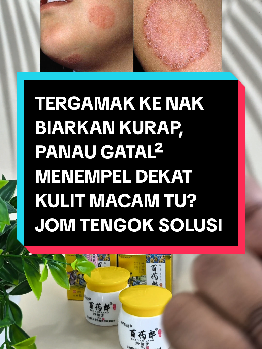 Replying to @salina.saidi khusus untuk mereka yang ada masalah kurap, enzem, gatal2. #krimgatal #krimenzema #enzema #kulitmerah #krimgatalviral 