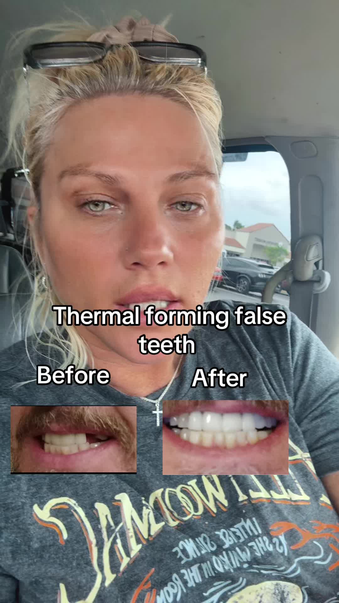 #teeth #tiktokshop #falseteeth 