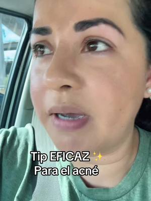 #acne #tips #fypシ #tiktokviral 