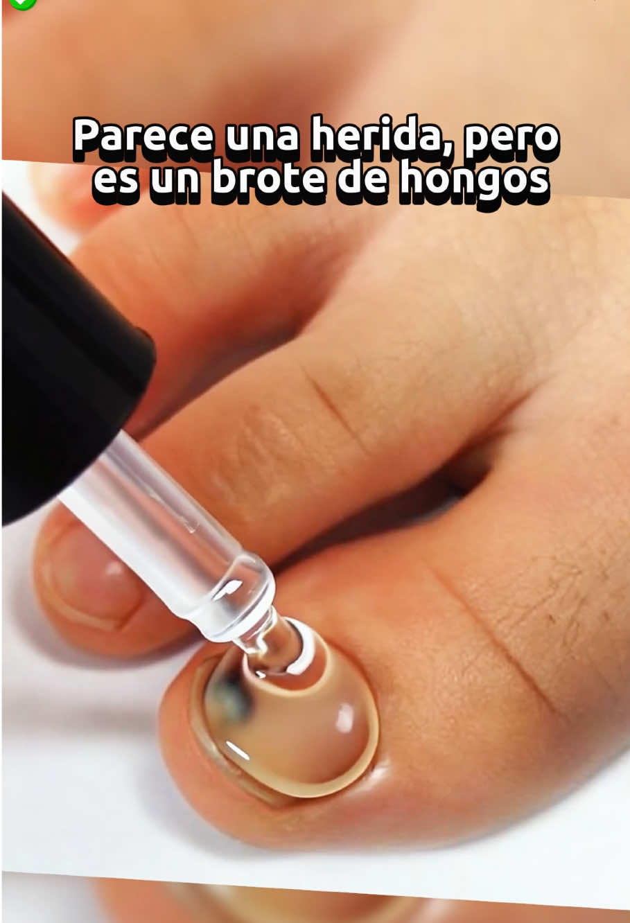 Si tú también tienes esta situación, ¡puedes probar este método!#nailcare #selfcaresunday #nails #tiktokshop #fyp 