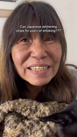 Now i need to whiten my teeth😅 #teethwhitening #yellowteeth #glowup #relatable #viral 
